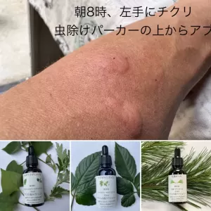 我が家の庭は薬箱　ブヨに刺されたけど薬草ヤブガラシオイルで１日で改善しましたよ！のサムネイル